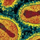 Illustration for article titled Should we once and for all eradicate smallpox?
